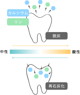 歯が溶けて虫歯になる仕組み